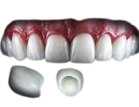 E-MAX CROWN